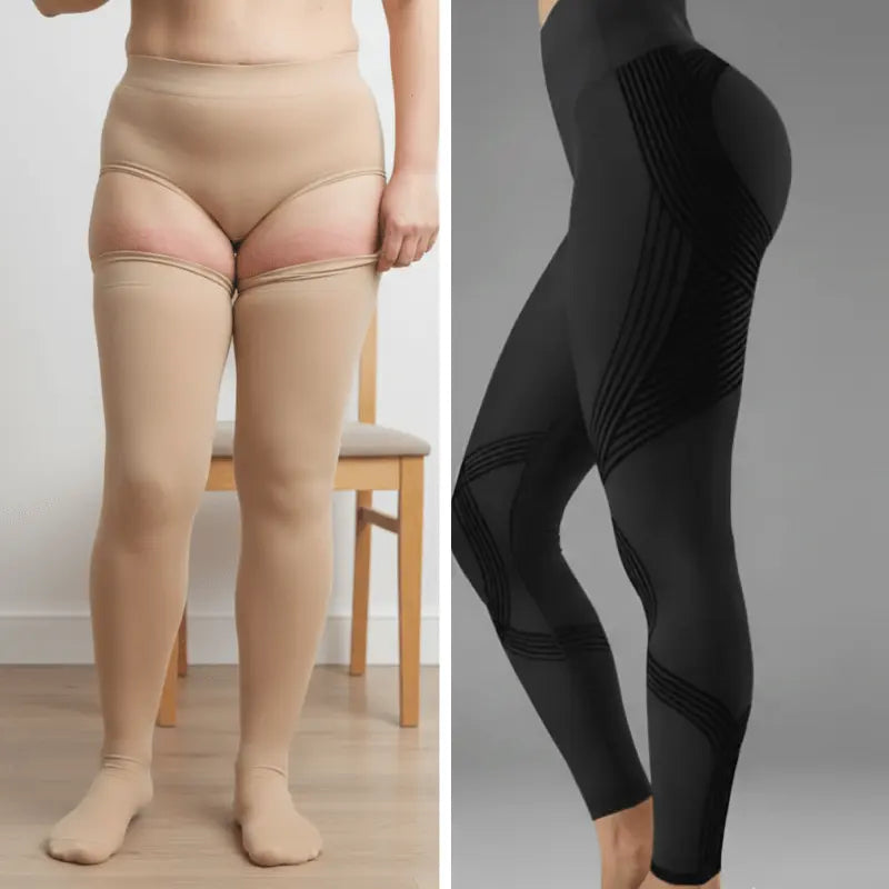 Bas de compression médicaux beiges traditionnels vs leggings noirs modernes