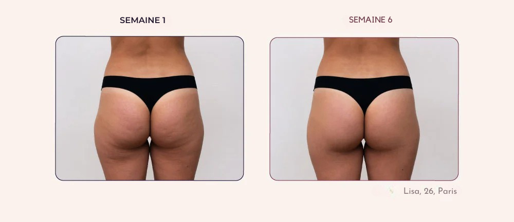 Résultats semaine 1 et semaine 6