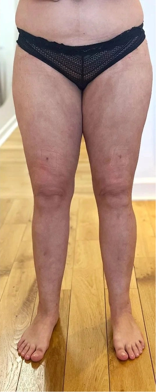 Après 14 jours